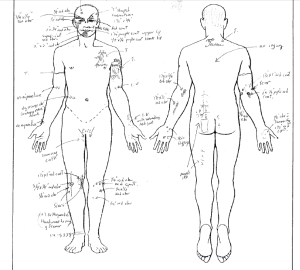 omar-abrego-autopsy-body-injuries